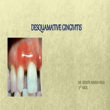 desquamative gingivitis