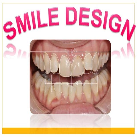 smile design