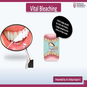 Vital Bleaching