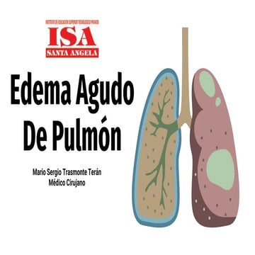SEMANA 10 EDEMA AGUDO dsadsDEL PULMÓN.pptx