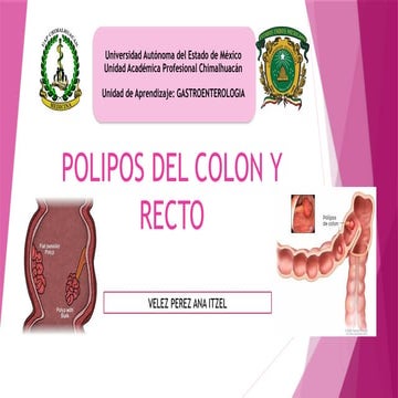 POLIPOS DEL COLON Y RECTO............... | PPTX