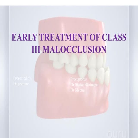 early treatment of class III malocclusion