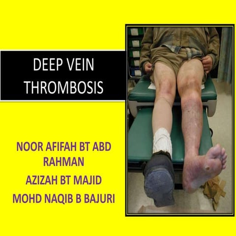 Venous thromboembolism.pptx