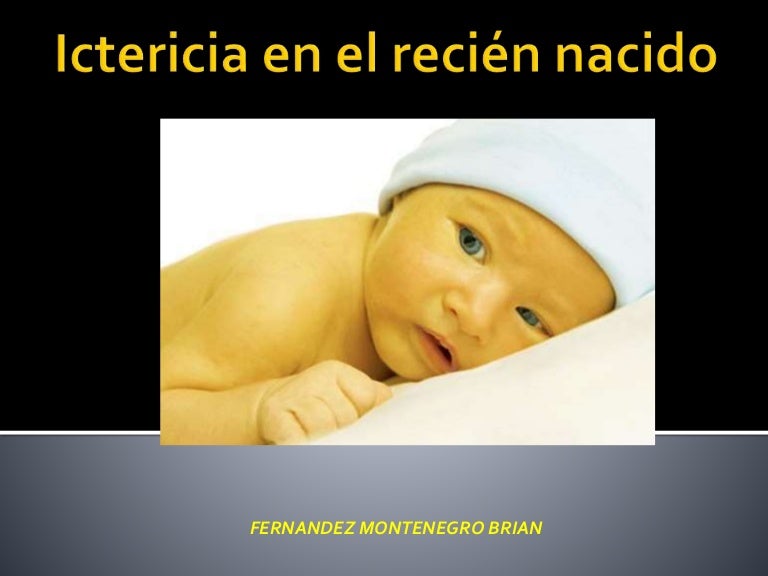 Ictericia Neonatal