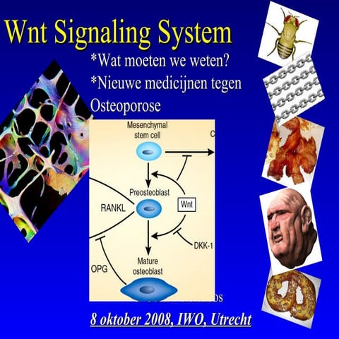 Seminar 08-10-2008 - wnt signaling system