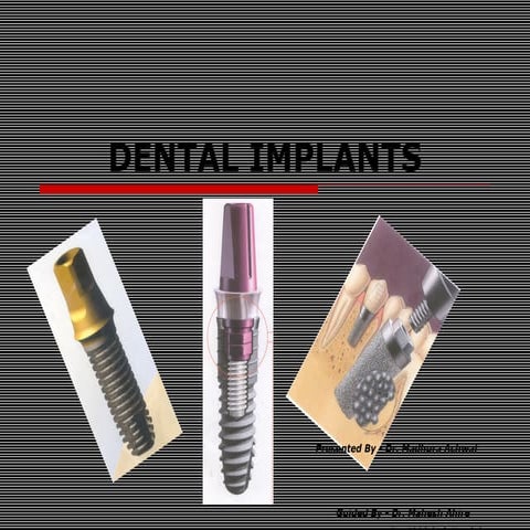 Osseointegration in Dental Implants | PPTX