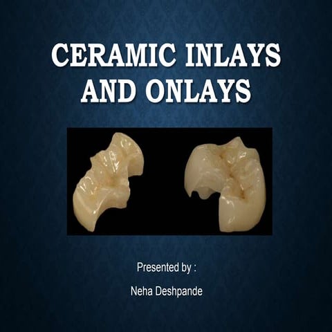 Ceramic inlays and onlays