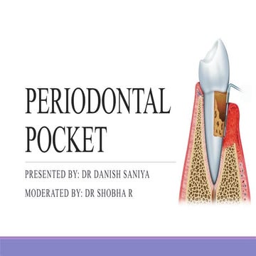 Seminar 8 Periodontal pocket part-1.pptx