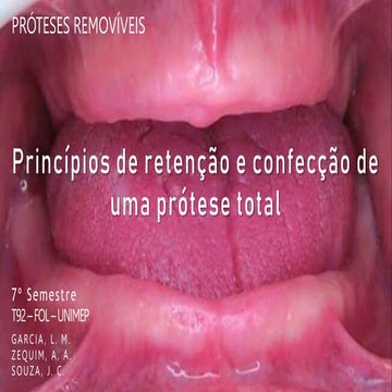 EXAME DO PACIENTE EDENTULO protese total | PPTX