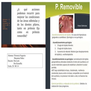 Seminario 13, corregido