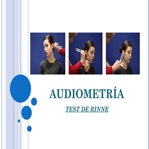 Prueba de Rinne | PPT