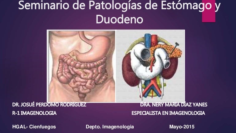 sintomas de ulcera nerviosa no estomago sintomas de ulcera nerviosa no estomago