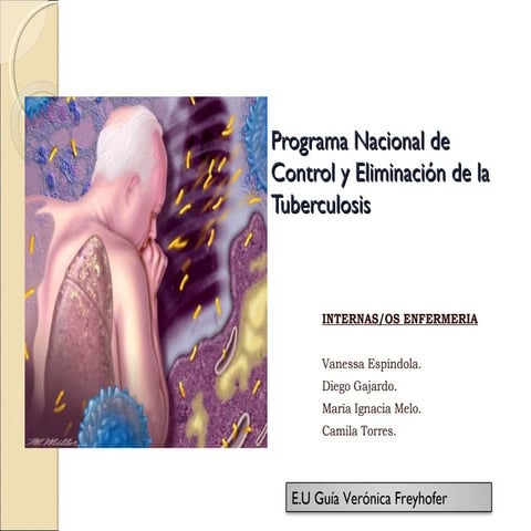 Seminario tbc (internos) 2