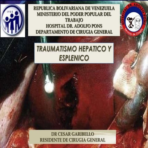 Seminario trauma hepatico
