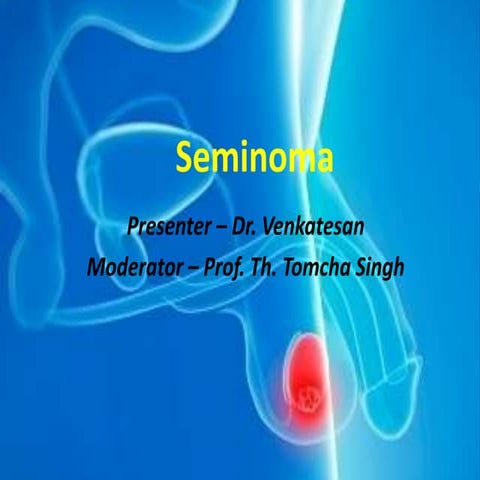 Seminoma