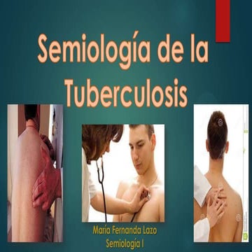 Semiología de la Tuberculosis