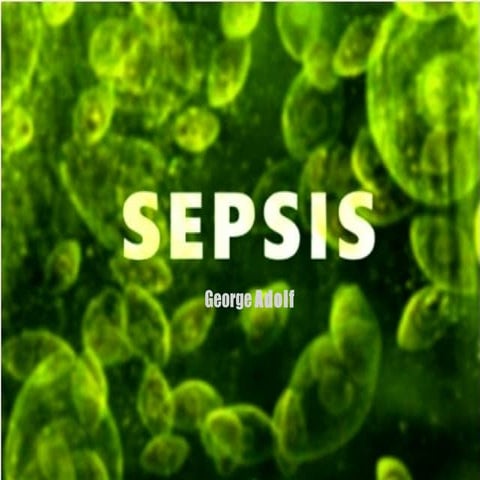 Sepsis project presentation
