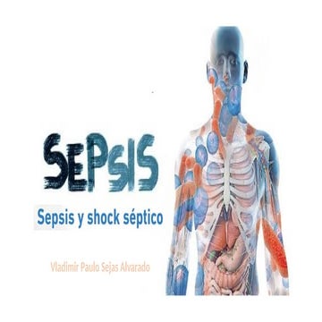 SEPSISS - pptx 1234567891011121314151617