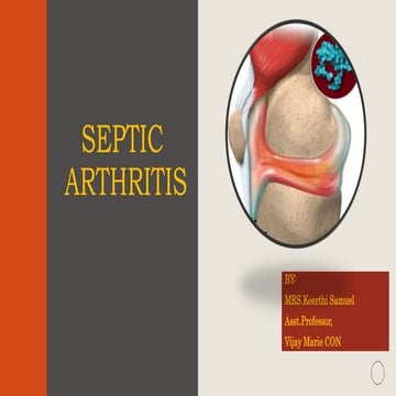 Septic arthritis