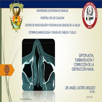 Septumplastia, turbinoplastia, valvuloplastia