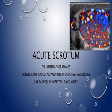 Ser 2016 acute scrotum 1  dr.amitha