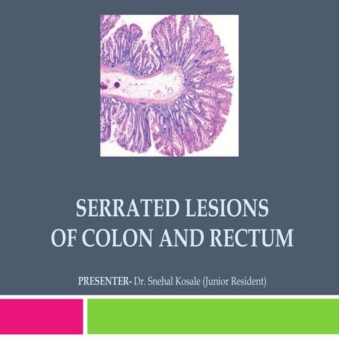 Serrated lesions of colon and rectum