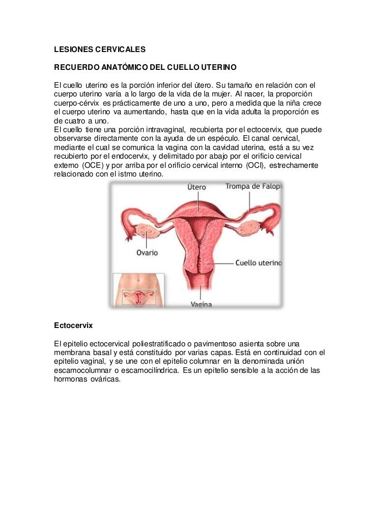 tratamiento para ulcera en cuello uterino