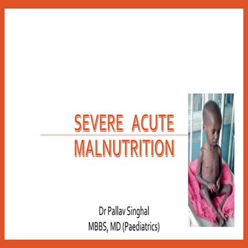 Severe acute malnutrition