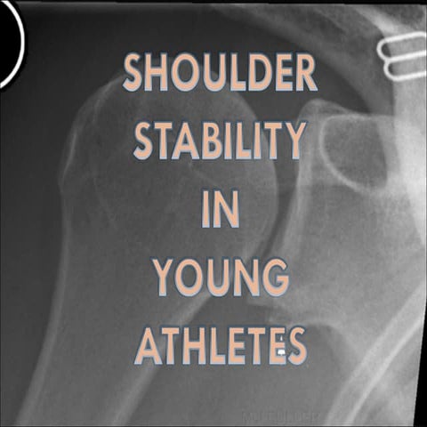 Shoulder instability 