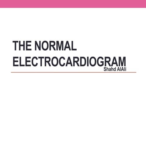 ECG 
