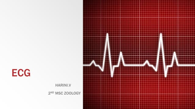 ECG