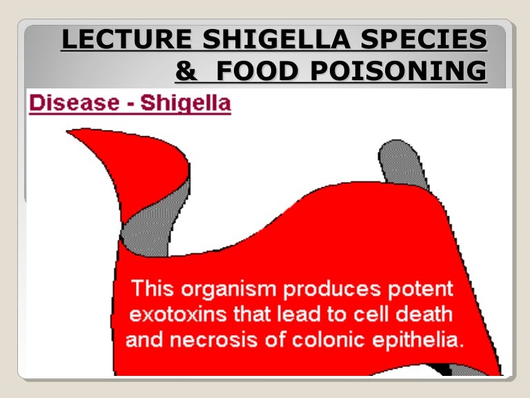 Shigella and Food Poisoning