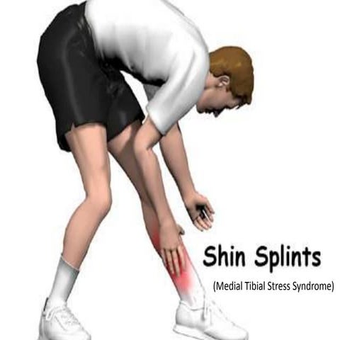 Shin splint presenta | PPTX
