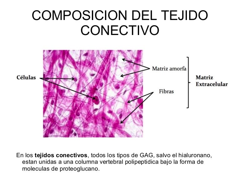 Diagrama Del Tejido Conectivo Reticular