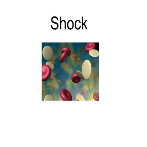 Shock