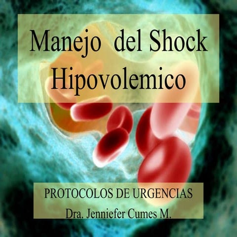 Shock Hipovolemico | PPTX