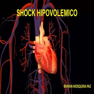 Shock Hipovolémico Definición – Shock Hipovolémico: Causas, Síntomas y ...