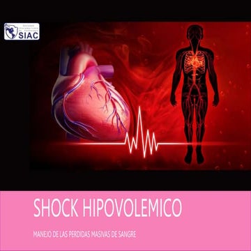 SHOCK HIPOVOLEMICO (1).pptx hipovolemico | PPTX