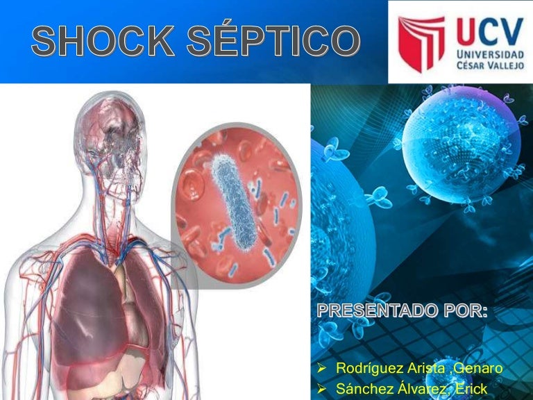 Shock sèptico