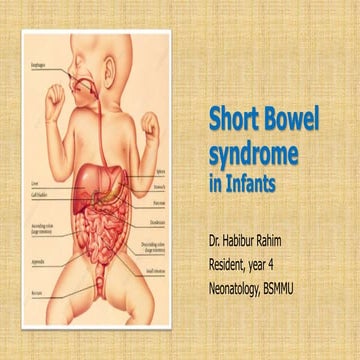 Short Bowel syndrome Dr Habibur Rahim