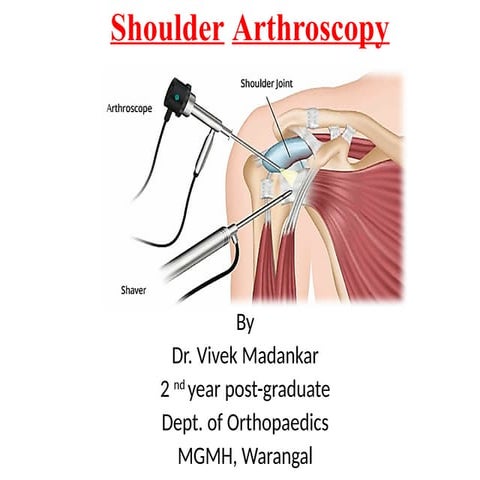 SHOULDER ARTHROSCOPY(instrumentation and shoulder in brief) | PPTX