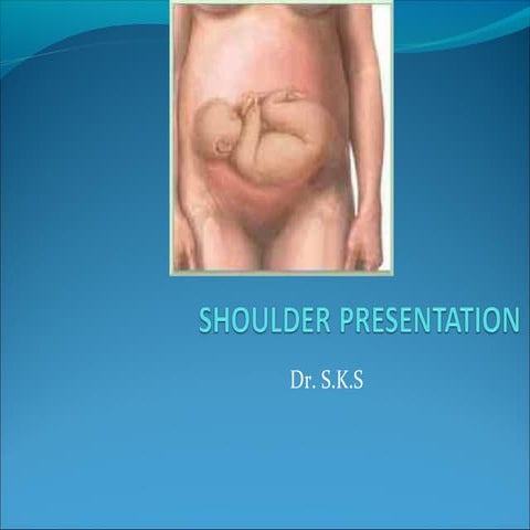 Shoulder  cord_presentation