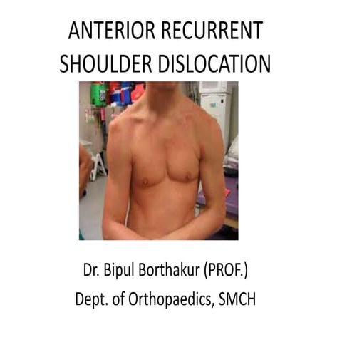 Shoulder disloaction