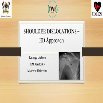 EMERGENCY DEPARTMENT APPROACH TO SHOULDER DISLOCATION- BY KAMOGA DICKSON.pptx