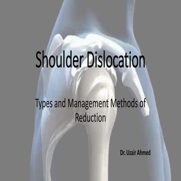 Shoulder dislocation: Types and Management Methods of Reduction