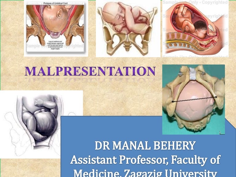 Shoulder Face Braw Compound Presention For Undergraduate