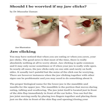 Should I be worried if my jaw clicks - Dr Muzzafar Zaman