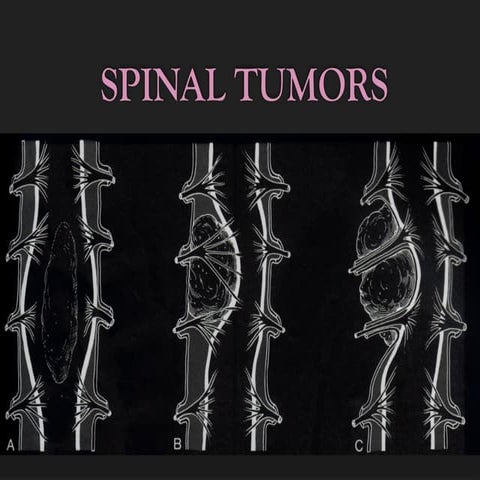 MRI Artifacts (introduction, classification, types) | PPTX