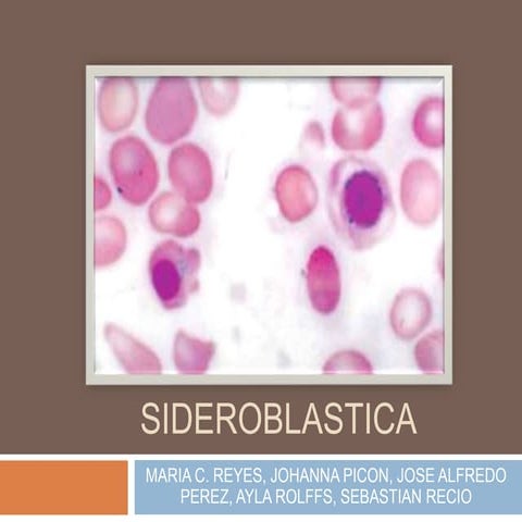 Anemia sideroblastica