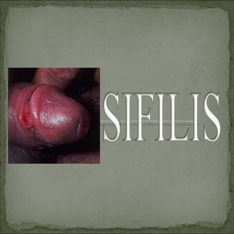 Sifilis
